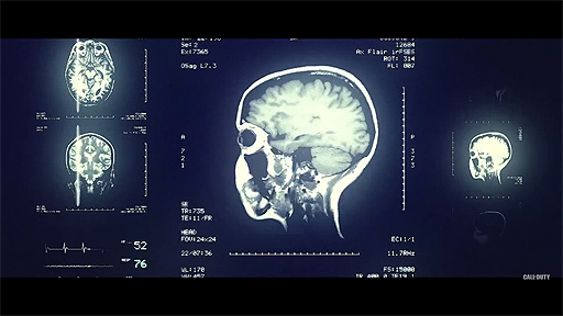 Official Call of Duty: Black Ops IIIEmberTeaseʺƷǡ