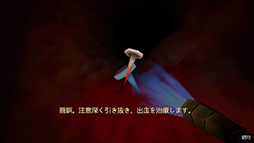 Revenge Of The Colon